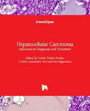 hepatocellular carcinoma: advances in diagnosis and treatment