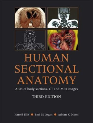 human sectional anatomy: atlas of body sections, ct and mri images – 3rd edition
