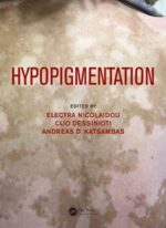 hypopigmentation
