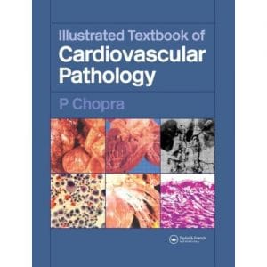 Illustrated Textbook of Cardiovascular Pathology