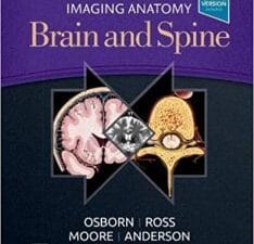 Imaging Anatomy Brain and Spine 1st Edition