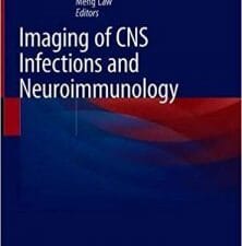 imaging of cns infections and neuroimmunology