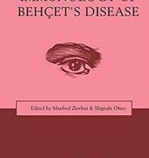 immunology of behcet’s disease