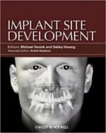 Implant Site Development 1st Edition