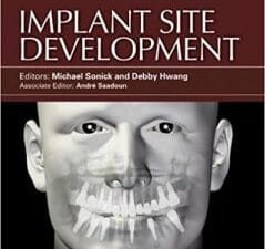Implant Site Development 1st Edition