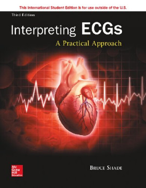interpreting ecgs: a practical approach