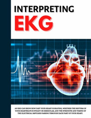 interpreting ekg: ekg interpretation for nurses | ekg interpretation practice
