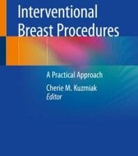 interventional breast procedures: a practical approach