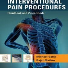 interventional pain procedures: handbook and video guide