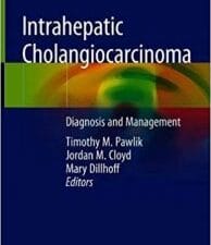 intrahepatic cholangiocarcinoma: diagnosis and management
