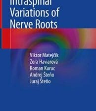 intraspinal variations of nerve roots