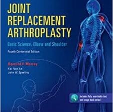 joint replacement arthroplasty: basic science, elbow, and shoulder