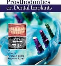 Journal of Prosthodontics on Dental Implants