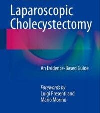 laparoscopic cholecystectomy: an evidence based guide