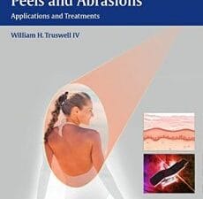 lasers and light, peels and abrasions