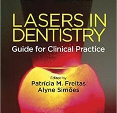 Lasers in Dentistry: Guide for Clinical Practice