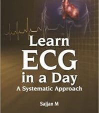 Learn ECG in a Day: A Systematic Approach 1st Edition