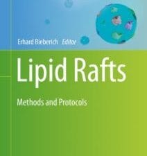 lipid rafts: methods and protocols