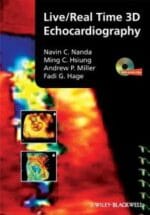 Live Real Time 3D Echocardiography