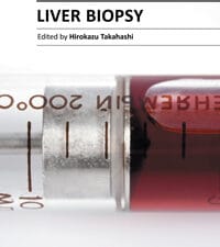 liver biopsy