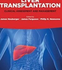 Liver Transplantation: Clinical Assessment and Management