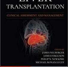 liver transplantation: clinical assessment and management 2nd edition