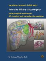 liver and biliary tract surgery