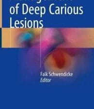 Management of Deep Carious Lesions