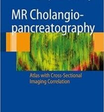 mr cholangiopancreatography: atlas with cross sectional imaging correlation