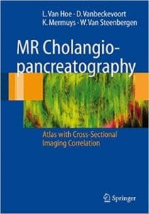mr cholangiopancreatography: atlas with cross sectional imaging correlation