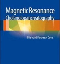 magnetic resonance cholangiopancreatography