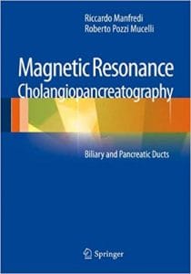 magnetic resonance cholangiopancreatography