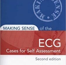 Making Sense of the ECG: Cases for Self Assessment 2nd Edition