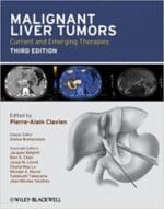malignant liver tumors: current and emerging therapies edition 3