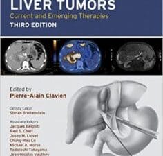 malignant liver tumors: current and emerging therapies edition 3