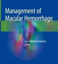 management of macular hemorrhage
