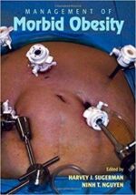 management of morbid obesity 1st edition