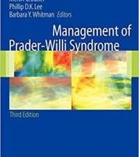 management of prader willi syndrome