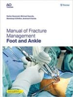 manual of fracture management – foot and ankle illustrated edition