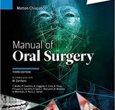 Manual of oral surgery