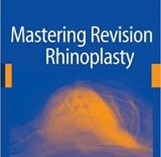 mastering revision rhinoplasty