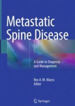 metastatic spine disease: a guide to diagnosis and management