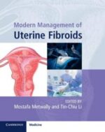 modern management of uterine fibroids