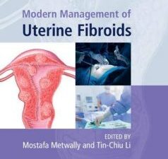 modern management of uterine fibroids