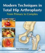 modern techniques in total hip arthroplasty: from primary to complex 1st edition