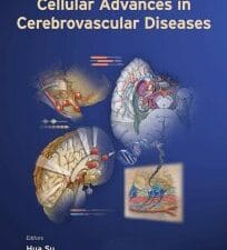 molecular, genetic, and cellular advances in cerebrovascular diseases