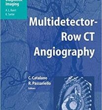multidetector row ct angiography