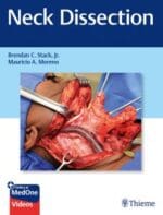 neck dissection
