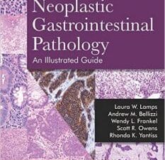 neoplastic gastrointestinal pathology: an illustrated guide