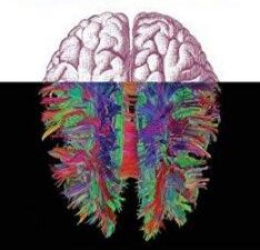 networks of the brain (the mit press)